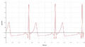 Bezprzewodowy czujnik EKG GDX-EKG